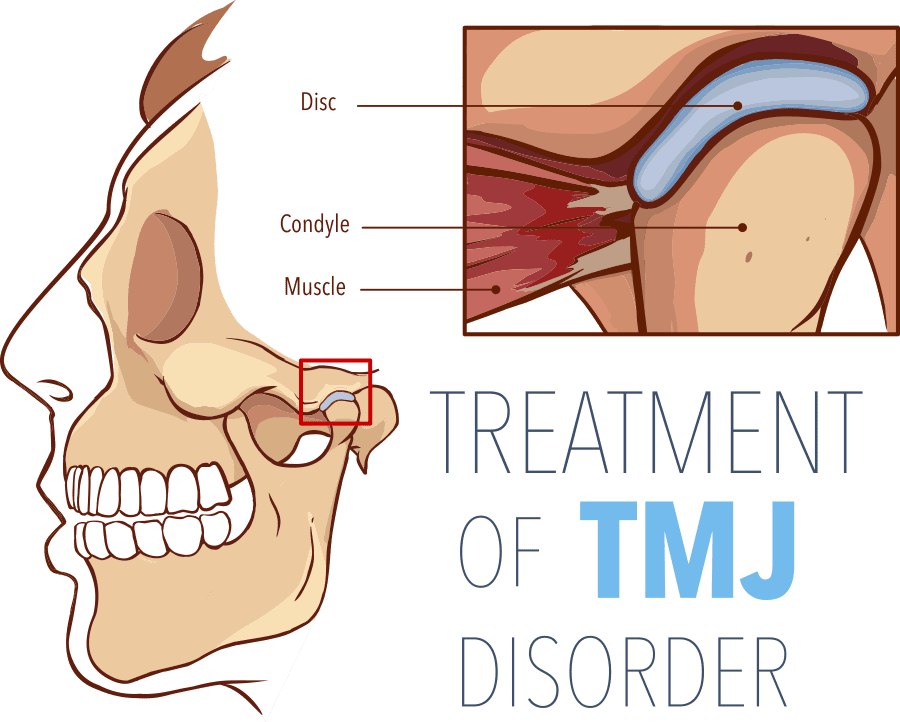TMJ disorder treatment